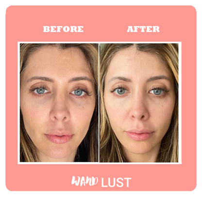 WandLust AeraForm™ Old